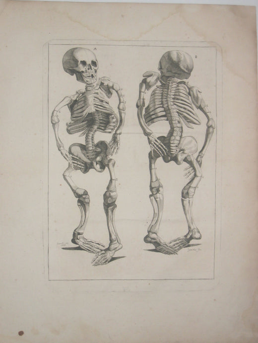 Squelettes difformes. 