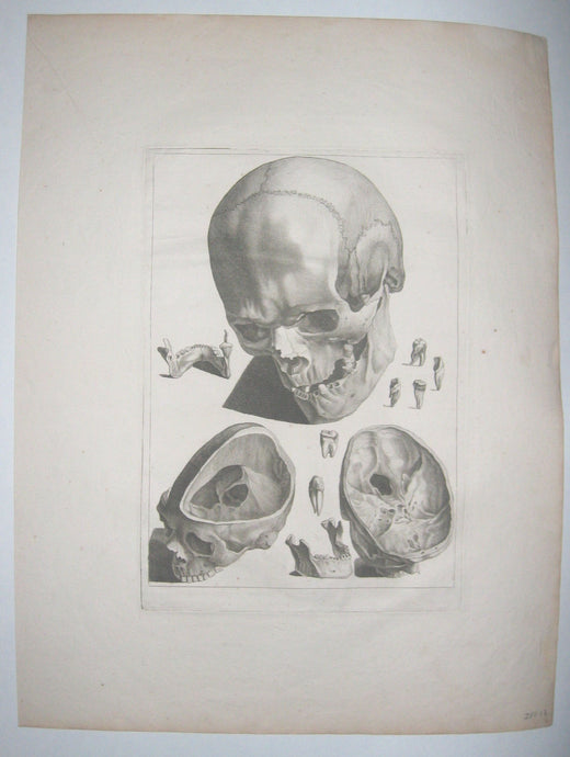 Crâne vu de trois-quart et os de la tête (la même).  
