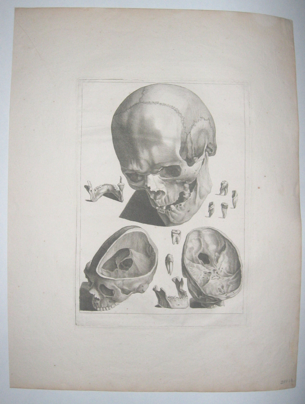 Crâne vu de trois-quart et os de la tête (la même).  